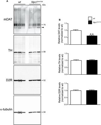 Anomalies in Dopamine Transporter Expression and Primary Cilium Distribution in the Dorsal Striatum of a Mouse Model of Niemann-Pick C1 Disease